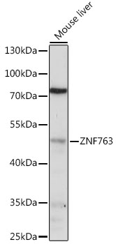 Western blot analysis of extracts of various cell lines using ZNF763 Polyclonal Antibody at 1:1000 dilution.