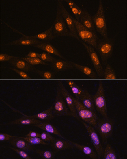 Immunofluorescence analysis of NIH/3T3 cells using YY2 Polyclonal Antibody at dilution of 1:100. Blue: DAPI for nuclear staining.