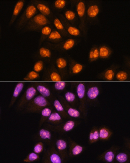 Immunofluorescence analysis of HeLa cells using YY2 Polyclonal Antibody at dilution of 1:100. Blue: DAPI for nuclear staining.