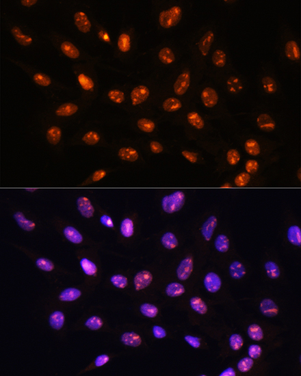 Immunofluorescence analysis of C6 cells using YY2 Polyclonal Antibody at dilution of 1:100. Blue: DAPI for nuclear staining.