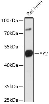 Western blot analysis of extracts of rat brain using YY2 Polyclonal Antibody at 1:1000 dilution.