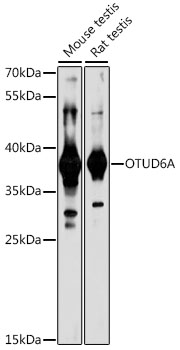 Western blot analysis of extracts of various cell lines using OTUD6A Polyclonal Antibody at 1:1000 dilution.