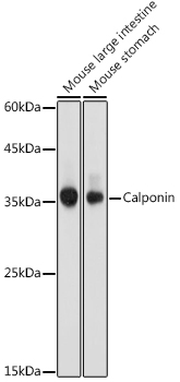 Western blot analysis of extracts of various cell lines using Calponin Polyclonal Antibody at 1:1000 dilution.