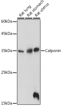 Western blot analysis of extracts of various cell lines using Calponin Polyclonal Antibody at 1:1000 dilution.