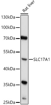 Western blot analysis of extracts of Rat liver using SLC17A1 Polyclonal Antibody at 1:1000 dilution.