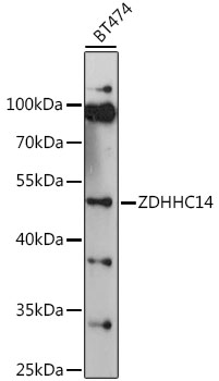 Western blot analysis of extracts of BT474 cells using ZDHHC14 Polyclonal Antibody at 1:1000 dilution.