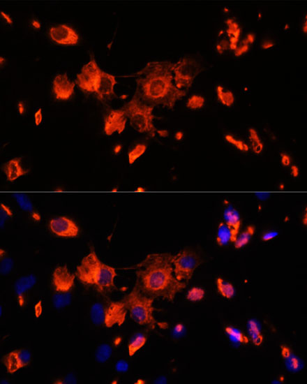 Immunofluorescence analysis of C6 cells using Vps18 Polyclonal Antibody at dilution of 1:100. Blue: DAPI for nuclear staining.