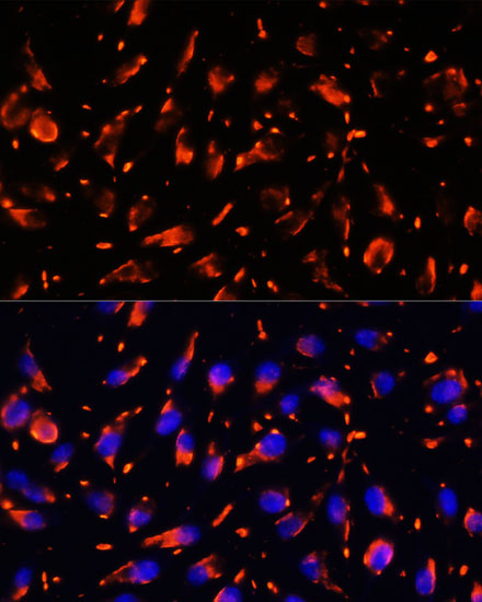 Immunofluorescence analysis of L929 cells using Vps18 Polyclonal Antibody at dilution of 1:100. Blue: DAPI for nuclear staining.