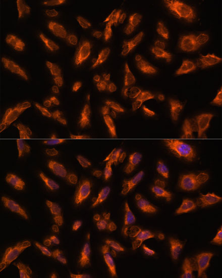 Immunofluorescence analysis of U2OS cells using Vps18 Polyclonal Antibody at dilution of 1:100. Blue: DAPI for nuclear staining.