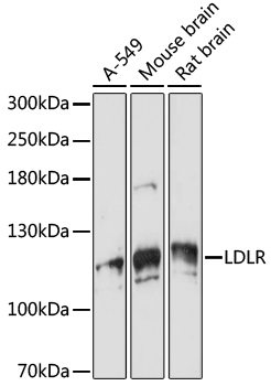 Western blot analysis of extracts of various cell lines using VPS18 Polyclonal Antibody at 1:1000 dilution.