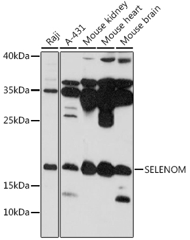 Western blot analysis of extracts of various cell lines using SELENOM Polyclonal Antibody at 1:1000 dilution.