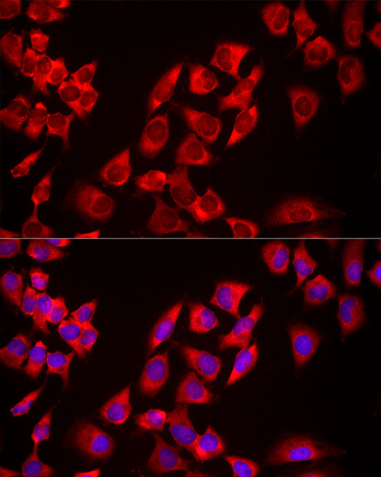 Immunofluorescence analysis of HeLa cells using USP21 Polyclonal Antibody at dilution of 1:100 (40x lens). Blue: DAPI for nuclear staining.