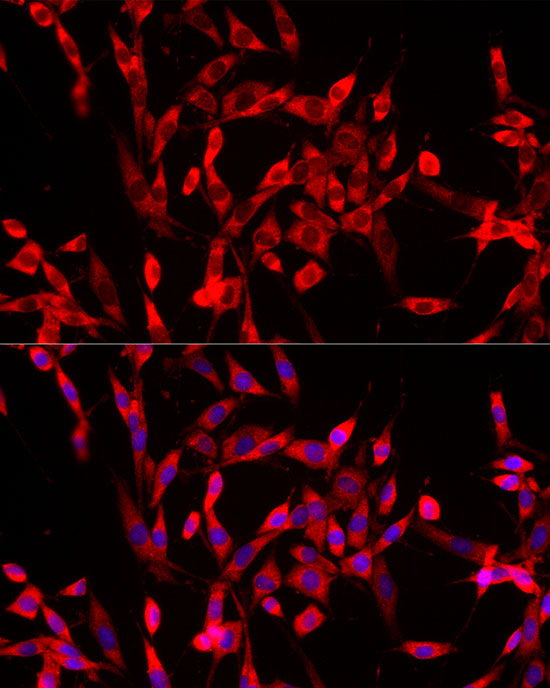 Immunofluorescence analysis of PC-12 cells using USP21 Polyclonal Antibody at dilution of 1:100 (40x lens). Blue: DAPI for nuclear staining.