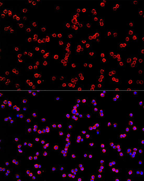 Immunofluorescence analysis of RAW264.7 cells using USP21 Polyclonal Antibody at dilution of 1:100 (40x lens). Blue: DAPI for nuclear staining.