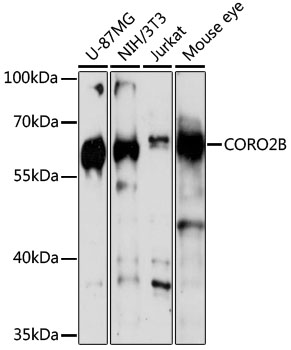 Western blot analysis of extracts of various cell lines using CORO2B Polyclonal Antibody at 1:3000 dilution.