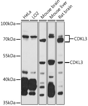 Western blot analysis of extracts of various cell lines using CDKL3 Polyclonal Antibody at 1:1000 dilution.