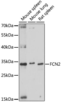 Western blot analysis of extracts of various cell lines using FCN2 Polyclonal Antibody at 1:1000 dilution.