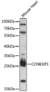 Western blot analysis of extracts of mouse heart using CCNB1IP1 Polyclonal Antibody at 1:1000 dilution.