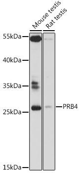 Western blot analysis of extracts of various cell lines using PRB4 Polyclonal Antibody at 1:1000 dilution.