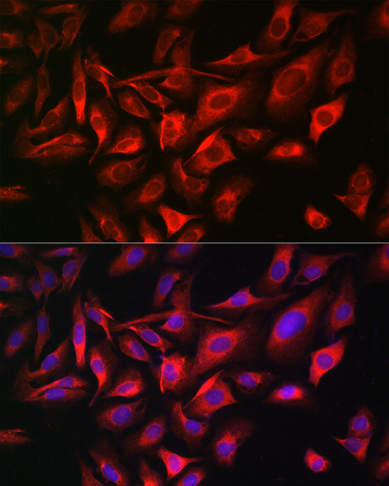 Immunofluorescence analysis of U2OS cells using TGN46/TGN46/TGOLN2 Polyclonal Antibody at dilution of 1:100 (40x lens). Blue: DAPI for nuclear staining.