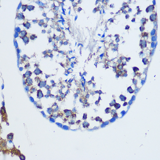 Immunohistochemistry of paraffin-embedded Mouse testis using TGN46/TGN46/TGOLN2 Polyclonal Antibody at dilution of 1:100 (40x lens).Perform microwave antigen retrieval with 10 mM PBS buffer pH 7.2 before commencing with IHC staining protocol.