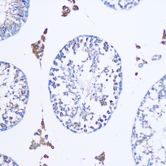 Immunohistochemistry of paraffin-embedded Mouse testis using TGN46/TGN46/TGOLN2 Polyclonal Antibody at dilution of 1:100 (20x lens).Perform microwave antigen retrieval with 10 mM PBS buffer pH 7.2 before commencing with IHC staining protocol.