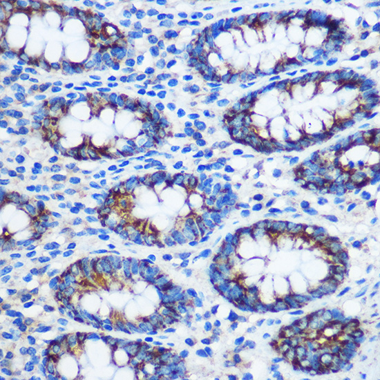 Immunohistochemistry of paraffin-embedded Human colon using TGN46/TGN46/TGOLN2 Polyclonal Antibody at dilution of 1:100 (40x lens).Perform microwave antigen retrieval with 10 mM PBS buffer pH 7.2 before commencing with IHC staining protocol.