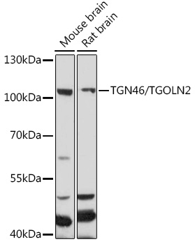 Western blot analysis of extracts of various cell lines using TGN46/TGN46/TGOLN2 Polyclonal Antibody at 1:1000 dilution.