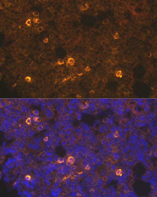 Immunofluorescence analysis of rat bone marrow using TPO-R/CD110/c-TPO-R/CD110/c-Mpl Polyclonal Antibody at dilution of 1:100 (40x lens). Blue: DAPI for nuclear staining.