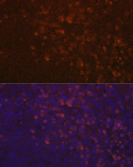 Immunofluorescence analysis of human spleen using TPO-R/CD110/c-TPO-R/CD110/c-Mpl Polyclonal Antibody at dilution of 1:100 (40x lens). Blue: DAPI for nuclear staining.