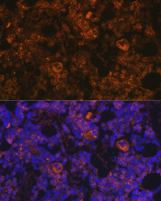 Immunofluorescence analysis of mouse bone marrow using TPO-R/CD110/c-TPO-R/CD110/c-Mpl Polyclonal Antibody at dilution of 1:100 (40x lens). Blue: DAPI for nuclear staining.