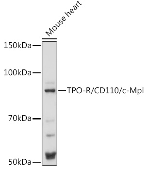Western blot analysis of extracts of Mouse heart using STX17 Polyclonal Antibody at 1:1000 dilution.