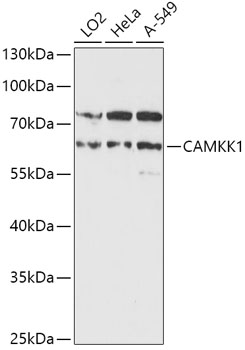 Western blot analysis of extracts of various cell lines using CAMKK1 Polyclonal Antibody at 1:1000 dilution.