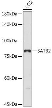 Western blot analysis of extracts of LO2 cells using SATB2 Polyclonal Antibody at 1:1000 dilution.