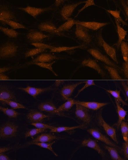 Immunofluorescence analysis of C6 cells using TFAP4 Polyclonal Antibody at dilution of 1:100. Blue: DAPI for nuclear staining.