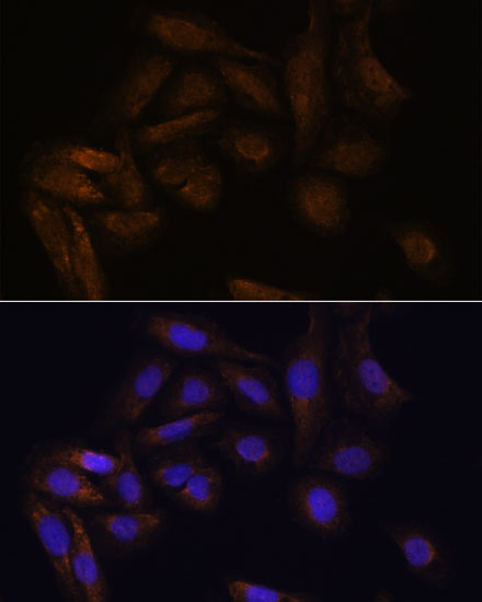 Immunofluorescence analysis of U2OS cells using TFAP4 Polyclonal Antibody at dilution of 1:100. Blue: DAPI for nuclear staining.