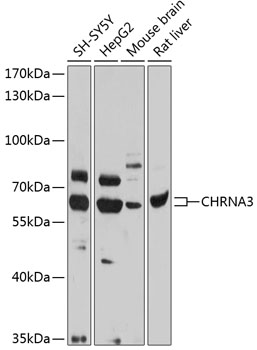 Western blot analysis of extracts of various cell lines using CHRNA3 Polyclonal Antibody at 1:1000 dilution.