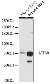 Western blot analysis of extracts of various cell lines using ATF6B Polyclonal Antibody at 1:1000 dilution.