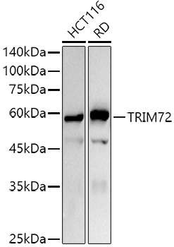 Western blot analysis of extracts of various cell lines using TRIM72 Polyclonal Antibody at 1:1000 dilution.