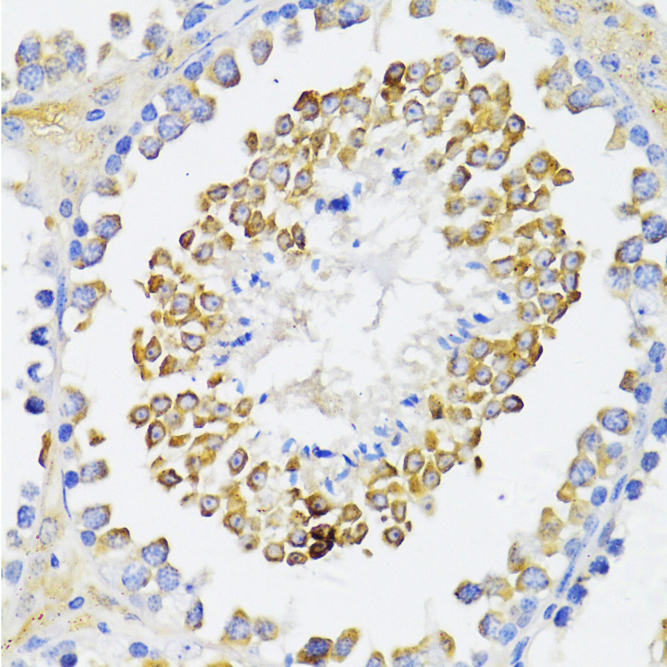 Immunohistochemistry of paraffin-embedded mouse testis using ARRB2 Polyclonal Antibody at dilution of 1:100 (40x lens).Perform microwave antigen retrieval with 10 mM PBS buffer pH 7.2 before commencing with IHC staining protocol.