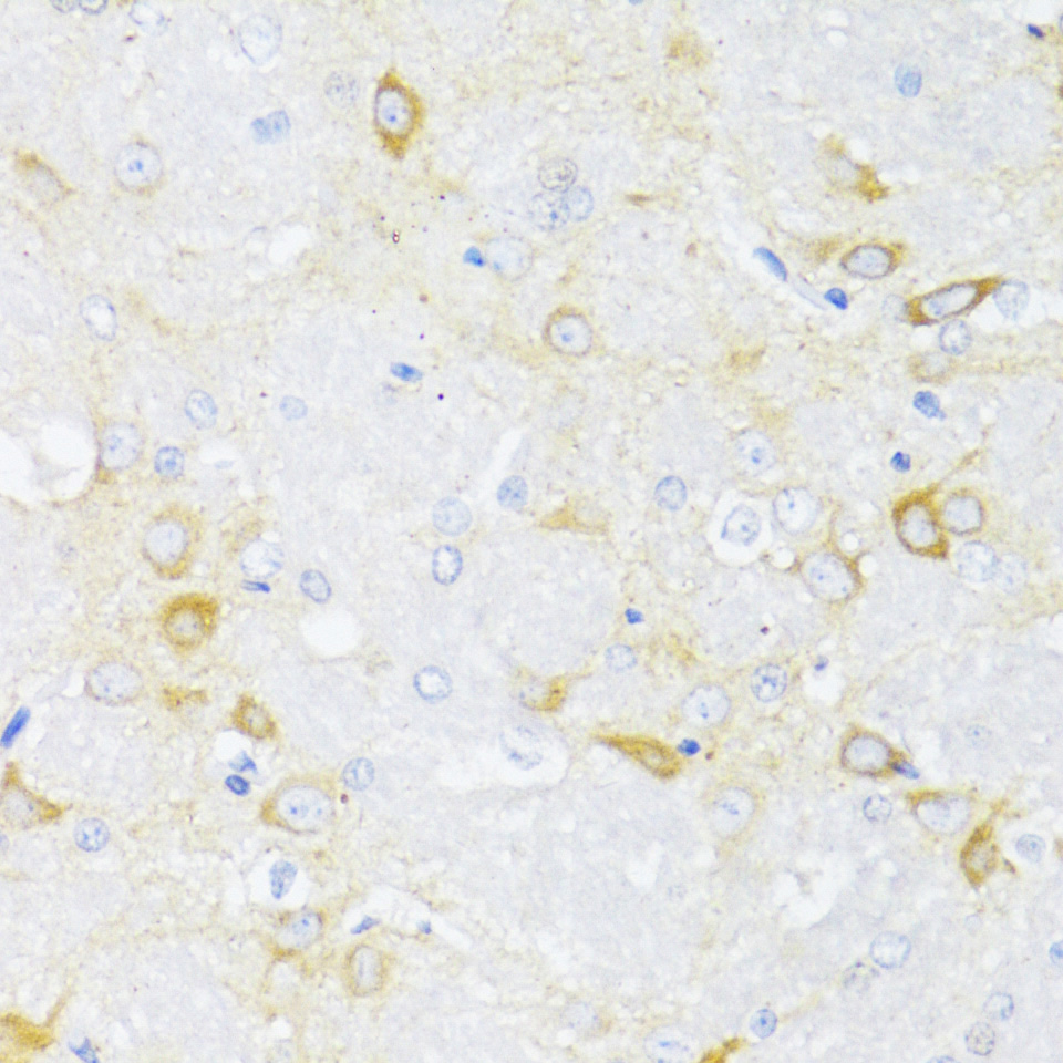 Immunohistochemistry of paraffin-embedded rat brain using ARRB2 Polyclonal Antibody at dilution of 1:100 (40x lens).Perform microwave antigen retrieval with 10 mM PBS buffer pH 7.2 before commencing with IHC staining protocol.