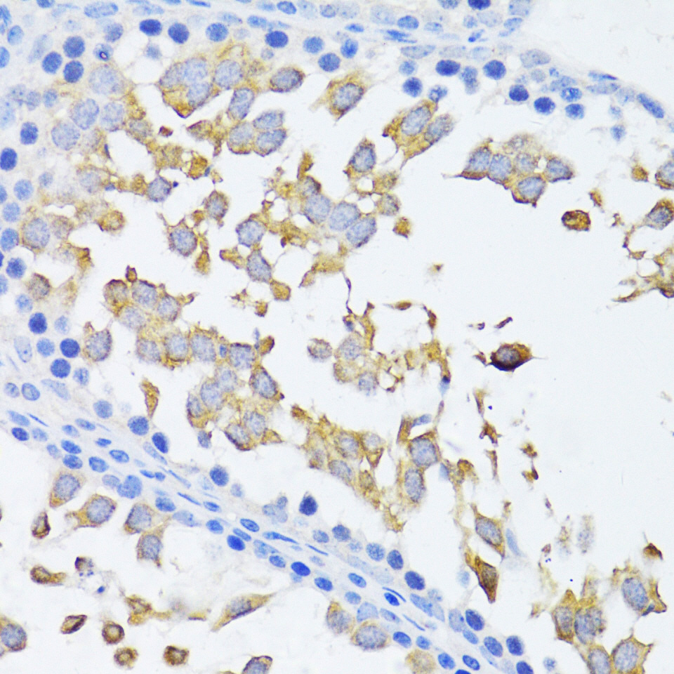 Immunohistochemistry of paraffin-embedded rat testis using ARRB2 Polyclonal Antibody at dilution of 1:100 (40x lens).Perform microwave antigen retrieval with 10 mM PBS buffer pH 7.2 before commencing with IHC staining protocol.