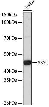 Western blot analysis of extracts of HeLa cells using ASS1 Polyclonal Antibody at1:3000 dilution.