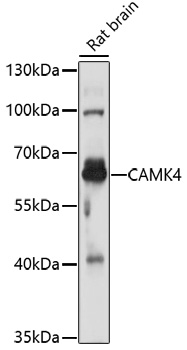 Western blot analysis of extracts of rat brain using CAMK4 Polyclonal Antibody at 1:1000 dilution.