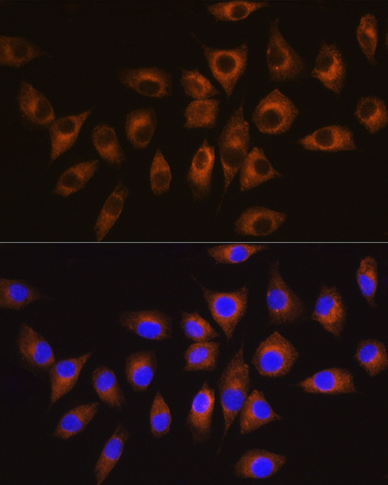 Immunofluorescence analysis of L929 cells using CSK Polyclonal Antibody at dilution of 1:100 (40x lens). Blue: DAPI for nuclear staining.