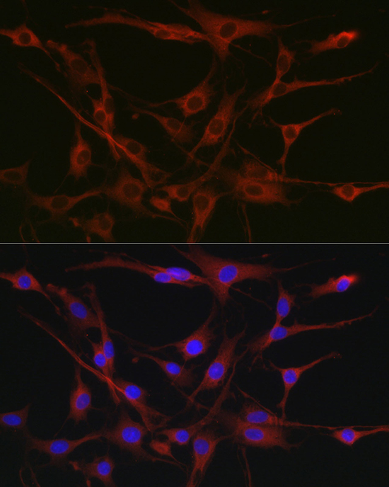 Immunofluorescence analysis of C6 cells using [KO Validated] CSK Polyclonal Antibody at dilution of 1:100 (40x lens). Blue: DAPI for nuclear staining.