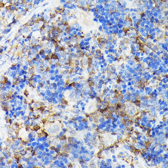 Immunohistochemistry of paraffin-embedded rat spleen using [KO Validated] CSK Polyclonal Antibody at dilution of 1:100 (40x lens).Perform high pressure antigen retrieval with 10 mM citrate buffer pH 6.0 before commencing with IHC staining protocol.