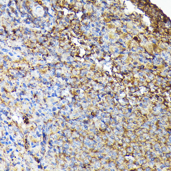 Immunohistochemistry of paraffin-embedded mouse spleen using [KO Validated] CSK Polyclonal Antibody at dilution of 1:100 (40x lens).Perform high pressure antigen retrieval with 10 mM citrate buffer pH 6.0 before commencing with IHC staining protocol.