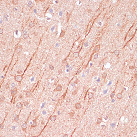 Immunohistochemistry of paraffin-embedded rat brain using DLG3 Polyclonal Antibody at dilution of 1:100 (40x lens).Perform microwave antigen retrieval with 10 mM PBS buffer pH 7.2 before commencing with IHC staining protocol.