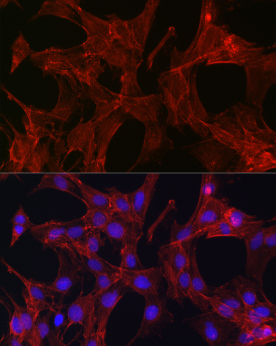 Immunofluorescence analysis of C6 cells using Gelsolin Polyclonal Antibody at dilution of 1:50 (40x lens). Blue: DAPI for nuclear staining.